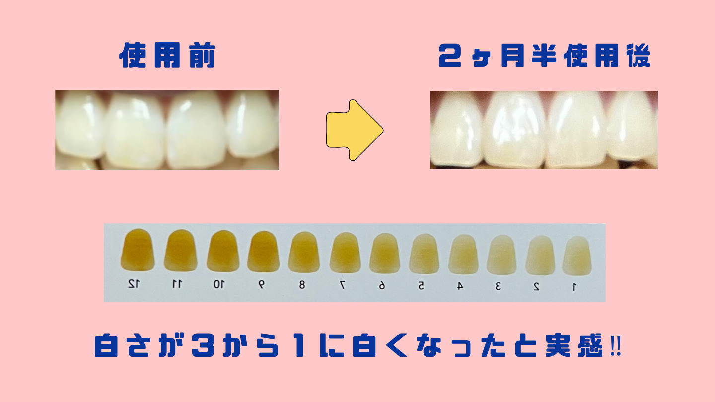 ホワイトニング Vussen 効果