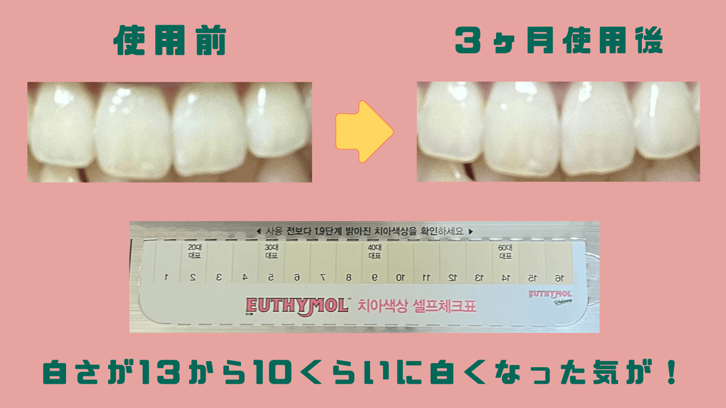 ユーシモール EUTHYMOL 効果 ビフォーアフター